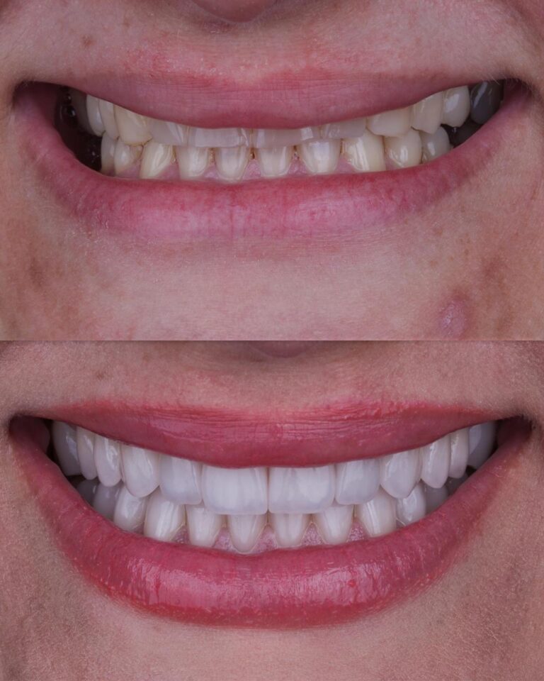 WhatsApp Image 2025-08-15 at 14.25.01